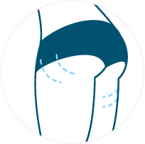 Symbol: Hautstraffung