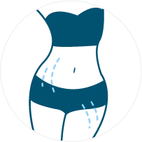 Symbol: Dehnungsstreifen
