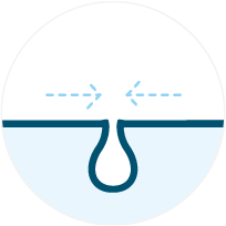 Symbol: vergrößerte Poren