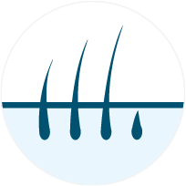 Symbol: Haarverlust