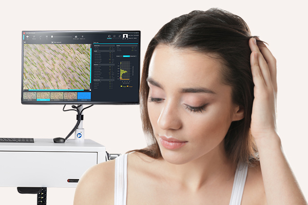 TrichoScale AI: Navigation der computergestützten Haaranalyse