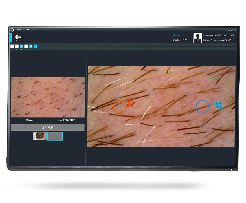 TrichoScale AI: Virtual Tattoo zur Verlaufsdokumentation