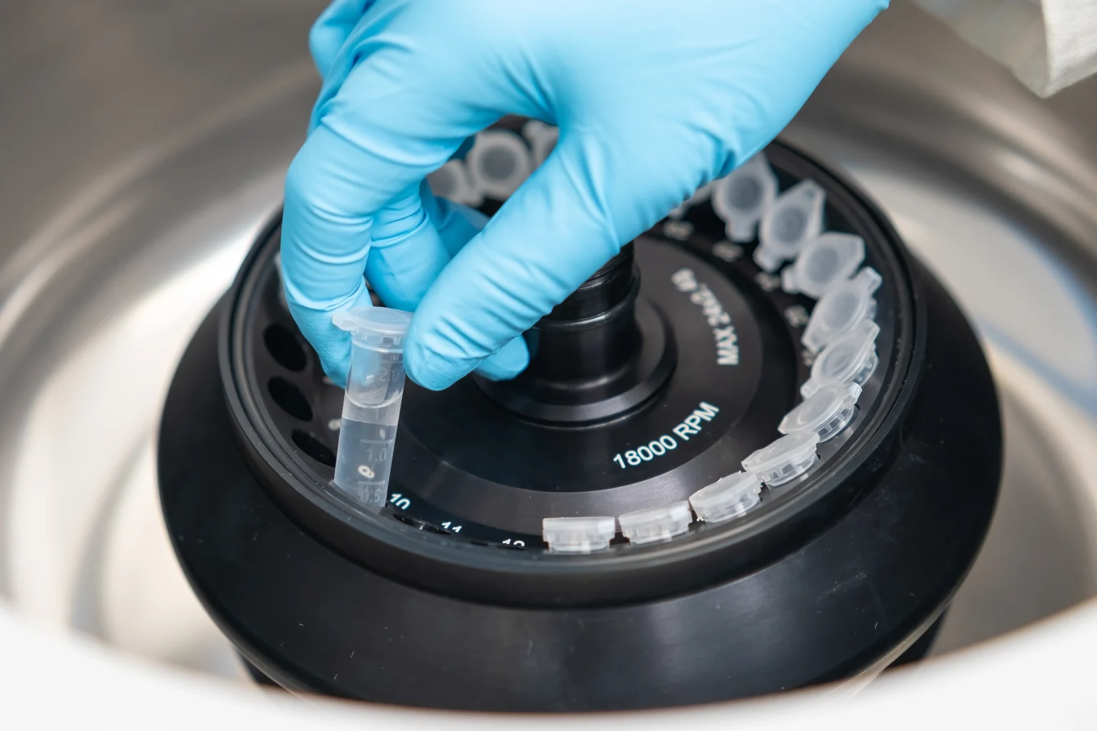 PRP-Eigenbluttherapie, Schritt 2: Zentrifugation des Blutes